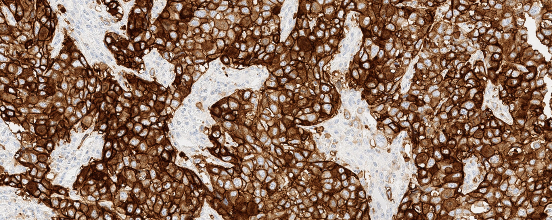 VENTANA PD-L1 (SP263) Assay — Roche Diagnostics product image