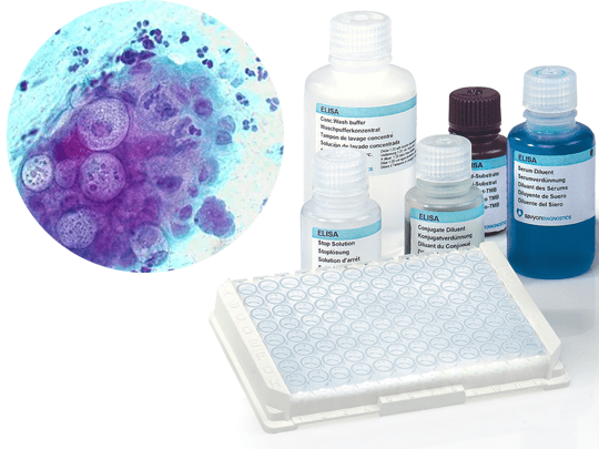 SeroELISA Chlamydia — Savyon Diagnostics Ltd. product image
