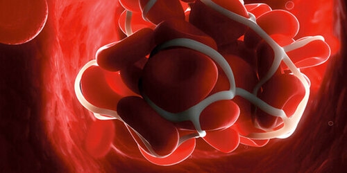 D-Dimer FS — DiaSys Diagnostic Systems product image