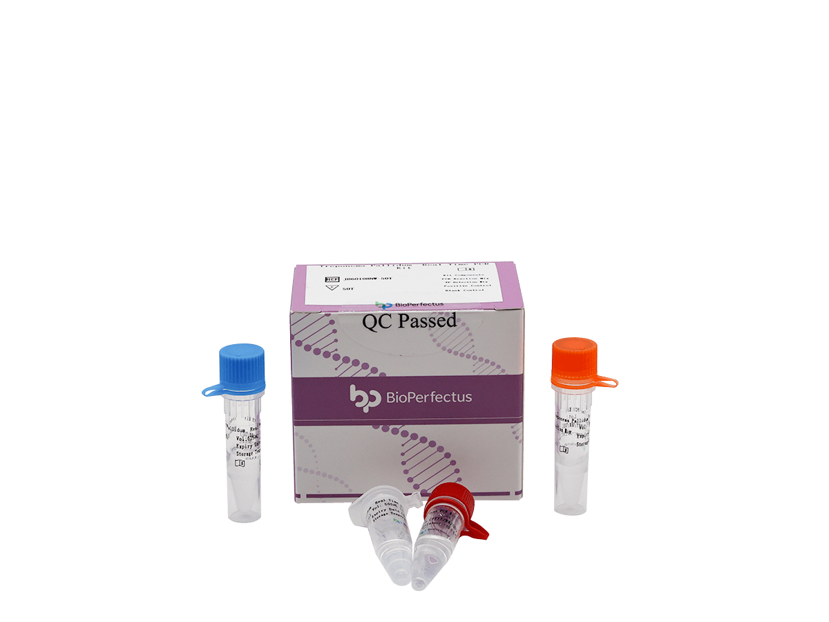 Treponema Pallidum Real Time PCR Kit — Jiangsu Bioperfectus Technologies Co., Ltd. product image