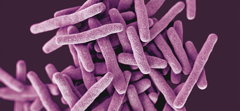Truenat® MTB Plus — Molbio Diagnostics Pvt. Ltd. product image
