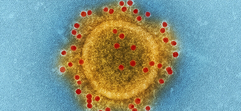 Truenat® H3N2/H1N1 — Molbio Diagnostics Pvt. Ltd. product image